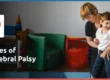 types of cerebral palys